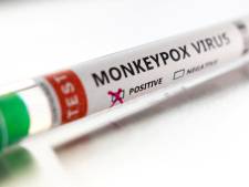 77 personnes infectées par la variole du singe identifiées en Belgique