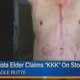 Man klaagt ziekenhuis aan om littekens Ku Klux Klan