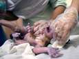 VN: "Dagelijks sterven wereldwijd nog 7.000 pasgeboren kinderen"