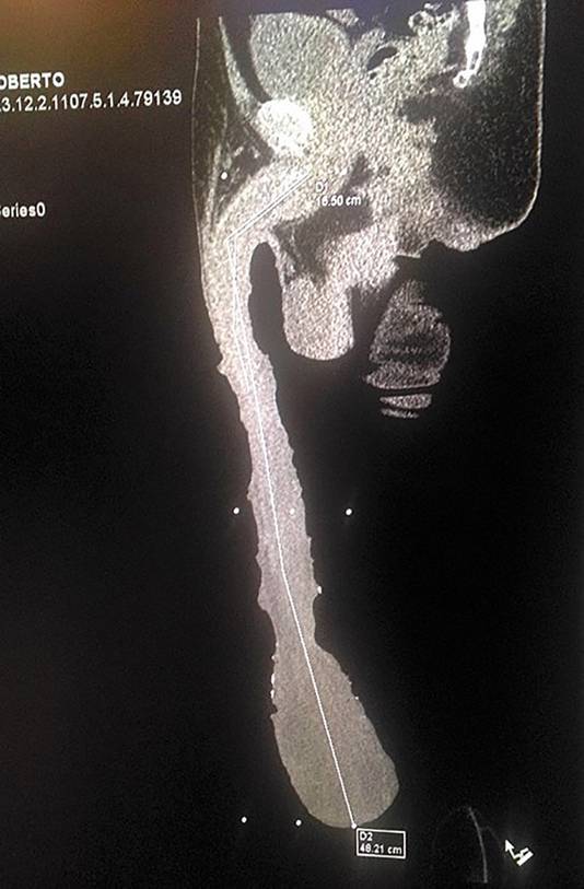 man met enorme penis door dat ding is mijn leven een hel bizar ad nl
