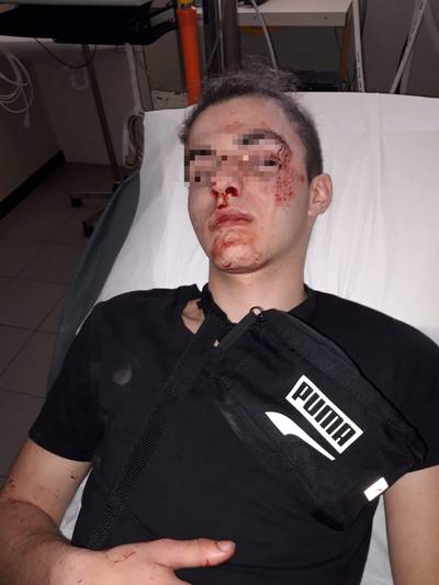 Jarno (16) in elkaar geslagen met ketting aan Deinze-station: “Veel passanten, maar niemand belde de politie”