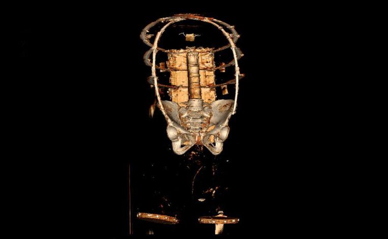 Scans van de babypop met een echt skeletje en het bekken in de bevalvrouw. Beeld LUMC