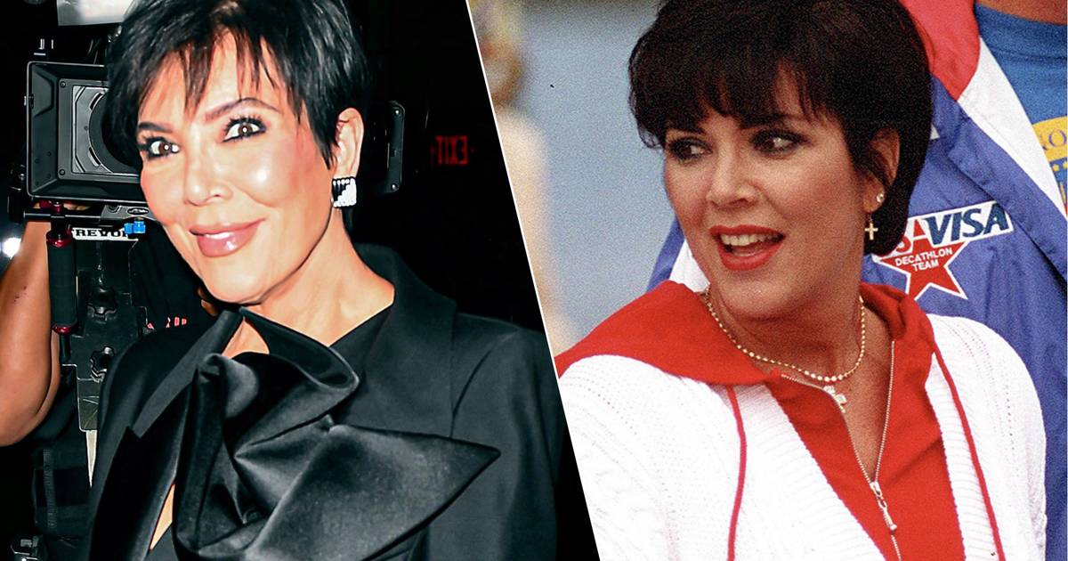 Un lavoro al naso di troppo per Kris Jenner?  I fan sono preoccupati: “Le sta crollando la narice” |  celebrità