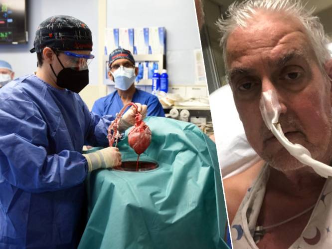 Na transplantatie van varkenshart bij mens: “Op termijn kan dit ook bij ons wachtlijsten inkorten”