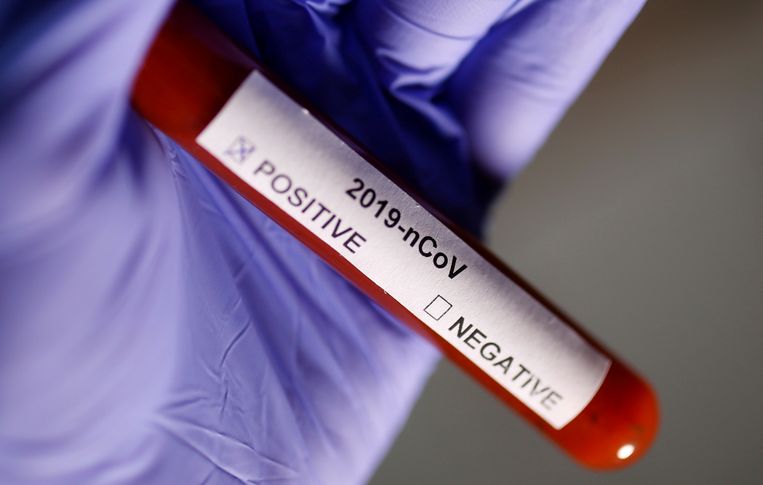 Alle sneltesten op corona wordendoor het RIVM als onbetrouwbaar beschouwd.  Beeld REUTERS