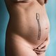 ‘Een vaginale bevalling is gewoon niet voor alle vrouwen geschikt’