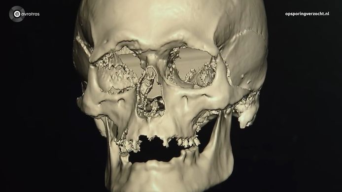 Op basis van een schedel wordt een gezichtsreconstructie gemaakt.