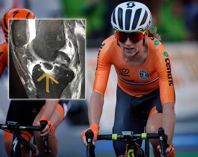 Van Vleuten reed tientallen kilometers met gebroken knie