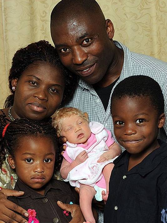 Deux Parents Noirs Un Bebe Blanc Insolite 7sur7 Be