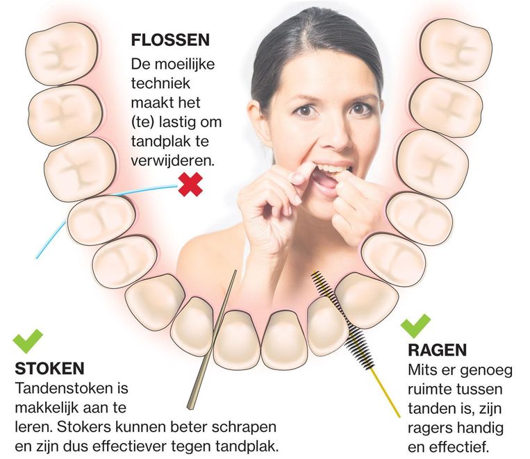 Machtigen Pessimist chirurg Zoals wij flossen heeft het geen zin | De Morgen