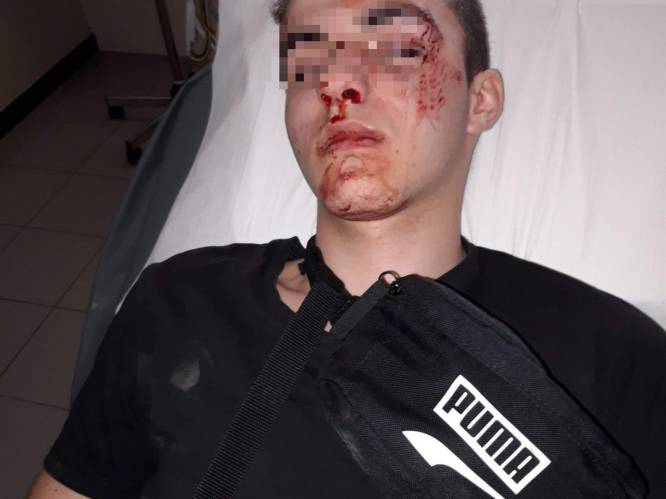 Jarno (16) in elkaar geslagen met ketting aan Deinze-station: “Veel passanten, maar niemand belde de politie”