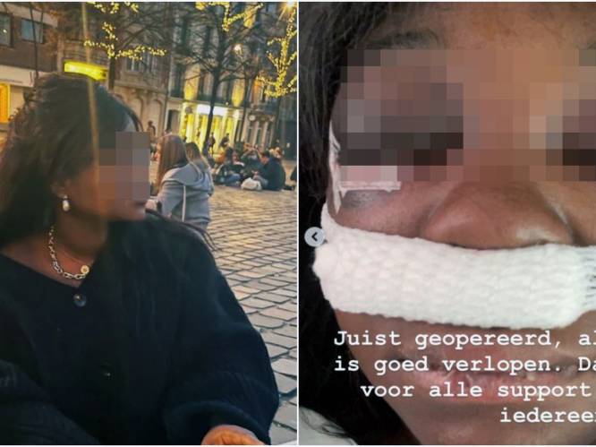 Politie Leuven reageert op aantijgingen van politiegeweld op sociale media