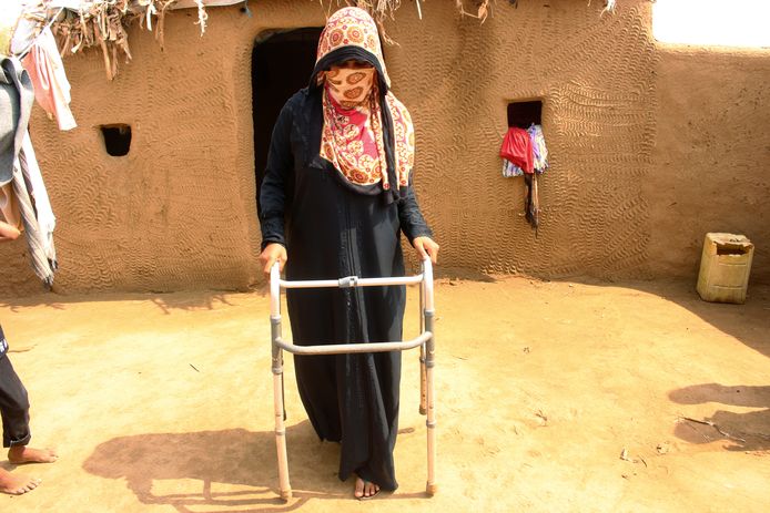 Een 26-jarige vrouw die door een kogel geraakt werd in haar been, probeert met een hulpstuk weer te lopen in een vluchtelingenkamp in Jemen.