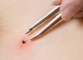 Gebeten door een teek? Dít zijn de symptomen van de ziekte van Lyme