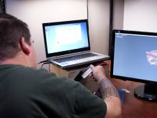 Un tétraplégique peut à nouveau bouger son bras grâce à un logiciel