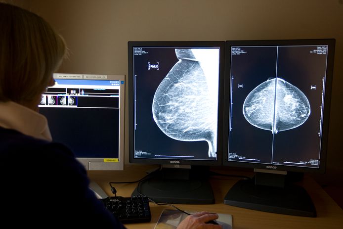 Ter illustratie: een radioloog bekijkt röntgenfoto van een borst.