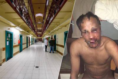 Gefolterde gevangene mag ziekenhuis verlaten en  moet niet meer terug naar de cel