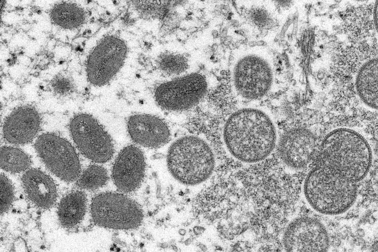 Het monkeypox-virus onder de microscoop na een Amerikaanse uitbraak in 2003.  Beeld CDC via AP