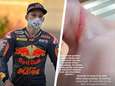 Remschijf snijdt bij zware crash in nek van Moto3-coureur (17): ‘Ik heb geluk dat ik nog leef’