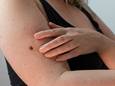 Dermatoloog over huidkanker: ‘Huidkleurig bultje dat snel groeit? Dan meteen naar de dokter’