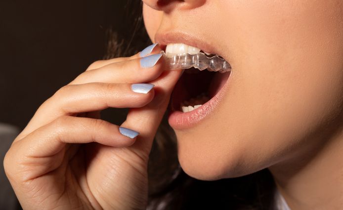 Een quasi onzichtbare beugel of Invisalign.