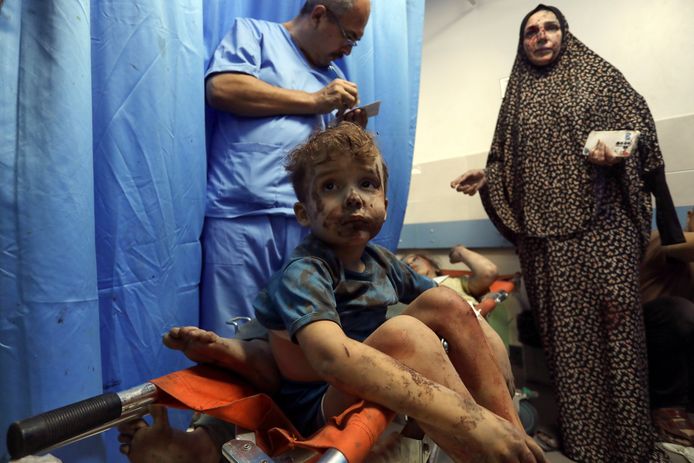 Gewone Palestijnen krijgen verzorging in het al-Shifa ziekenhuis in Gaza-stad.
