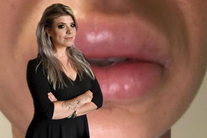 Renske Kruitbosch over fillers.