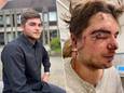 Sam Coli werd het slachtoffer van een laffe aanval in Brugge.