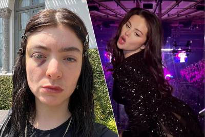 CELEB 24/7. Lorde surprises followers with a black eye and Selena Gomez goes wild to the music of Sabrina Carpenter