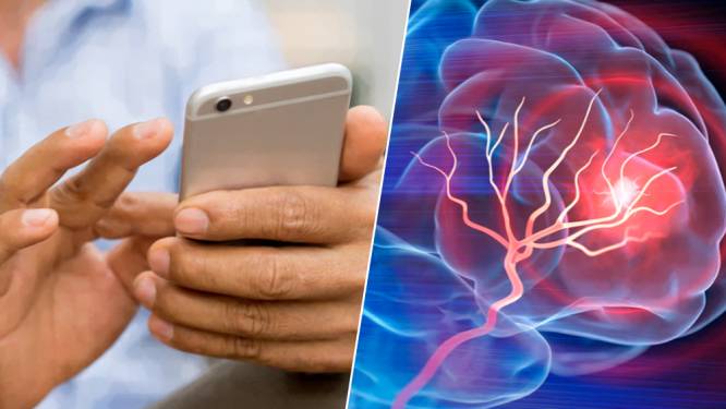 Dagelijks krijgen zo’n 60 mensen een beroerte: deze app kan een hersenbloeding helpen voorkomen