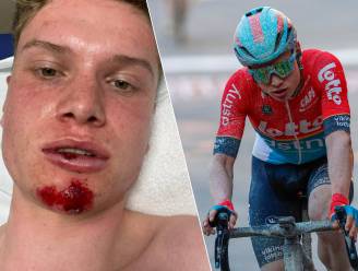 “Blij dat ik nog leef”: Lotto-renner Lennert Van Eetvelt zwaar gehavend na aanrijding door auto op training