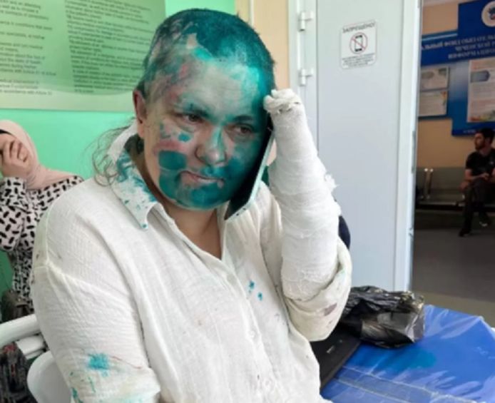 Jelena Milasjina werd zwaar aangepakt door gemaskerde mannen.