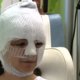 Video: Fanny overleefde aanslagen Brussel, maar zit onder de brandwonden