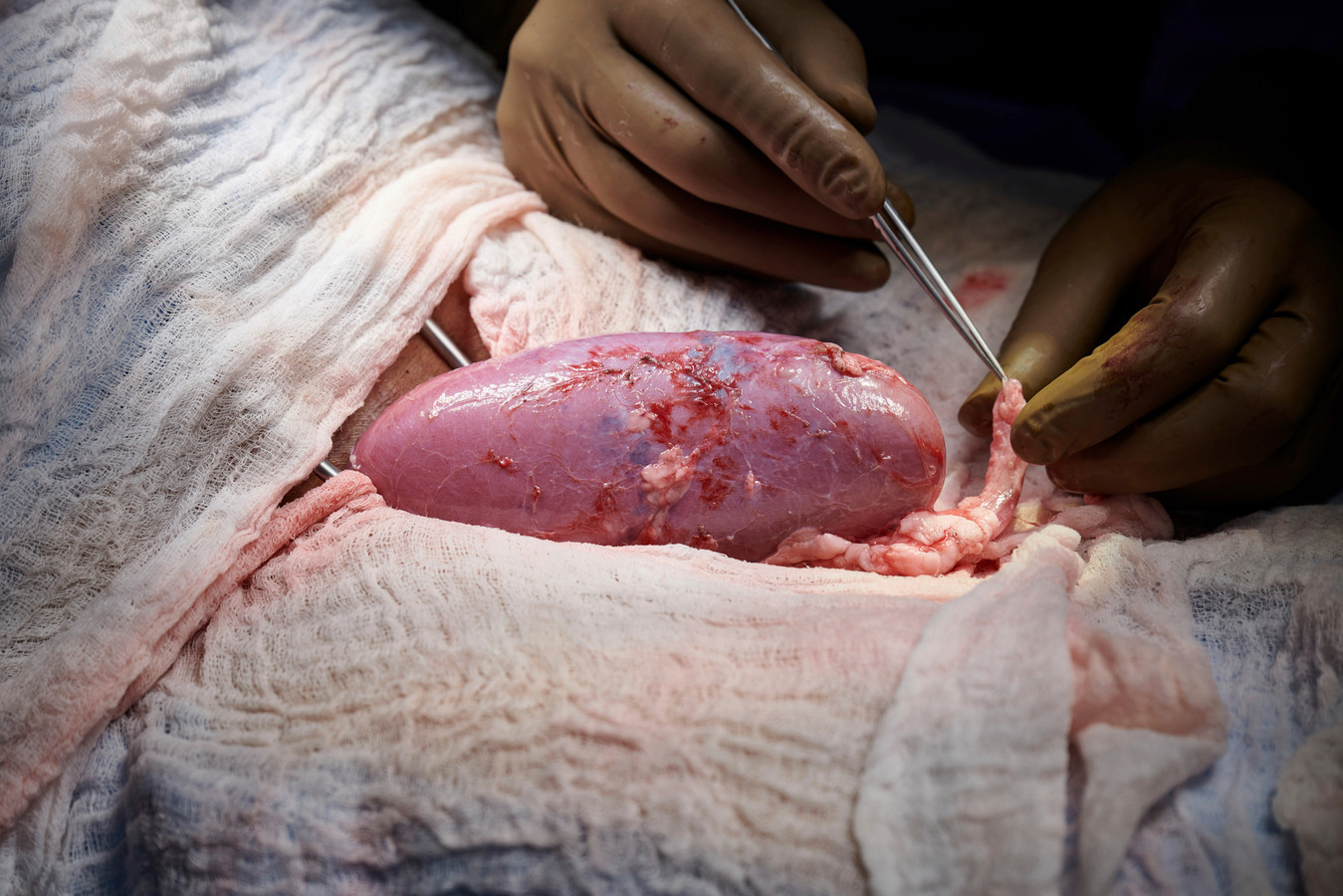 Het chirurgisch team onderzocht de varkensnier op tekenen van afstoting.