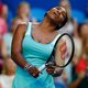 Serena Williams pijnlijk onderuit