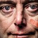 De dokter die wil legaliseren: 'Er bestaan geen soft- en harddrugs, alleen soft en hard gebruik'