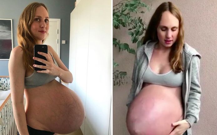 Maria (36) is 34 weken zwanger van een drieling. Op 12 september komen haar tweede, derde en vierde kindje ter wereld met een keizersnede.
