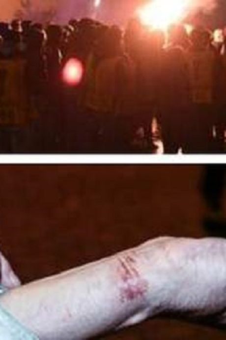 Les supporters de Bruges en colère, Mannaert se casse le poignet