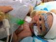 “Hij verdient een kans”: ouders laten baby met ernstige hartafwijking geboren worden, maar het gaat niet goed met hem