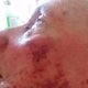 Bejaarde vrouw ernstig gewond na mishandeling door medebewoner