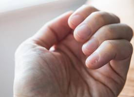 Last van velletjes rond je nagels? Zo verhelp én voorkom je die