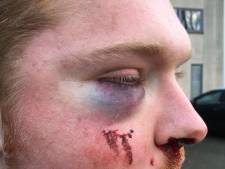 Waarom heeft politie verdachte van mishandeling op Stratumseind nog niet, met al die camera's?