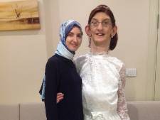 Turkse is met 2,15 meter de langste vrouw ter wereld