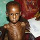 VN roept noodsituatie in Somalië uit tot hongersnood