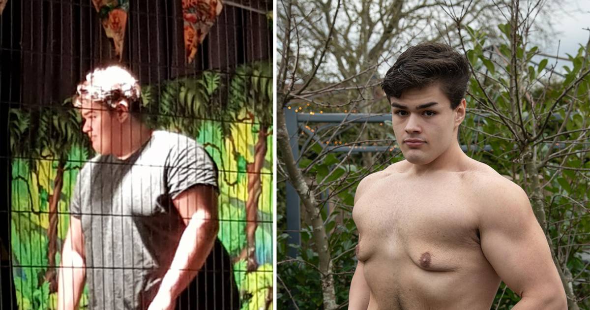 Dylan (18) viel 70 kilo af, maar operatie voor overtollig