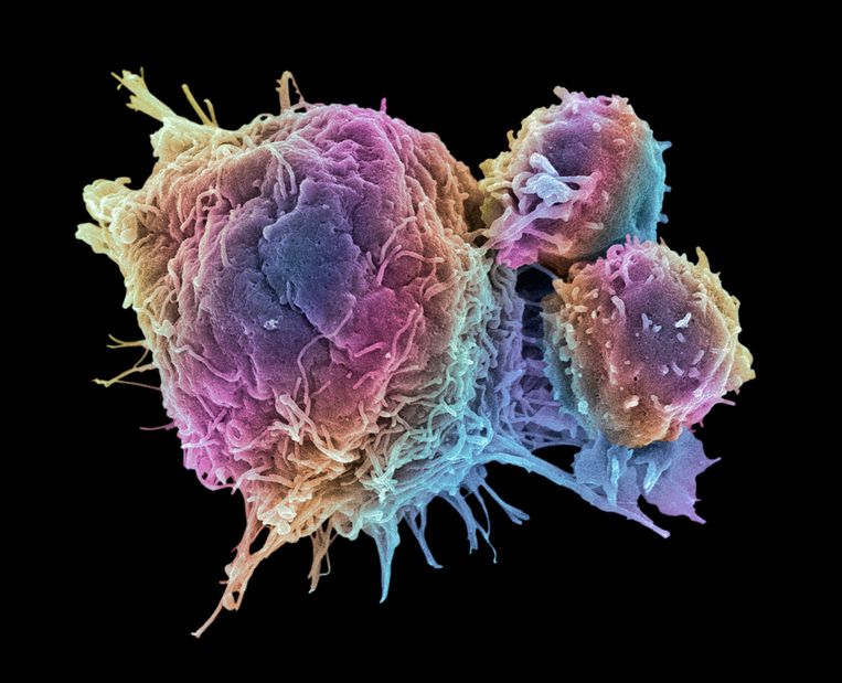 Opname van een kankercel door een rasterelektronenmicroscoop.  Beeld Getty Images/Science Photo Libra