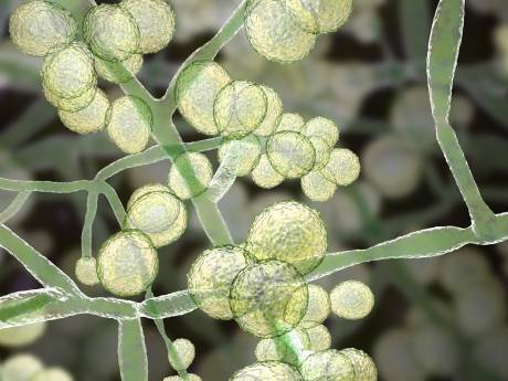 La propagation rapide d’un champignon potentiellement mortel inquiète les États-Unis