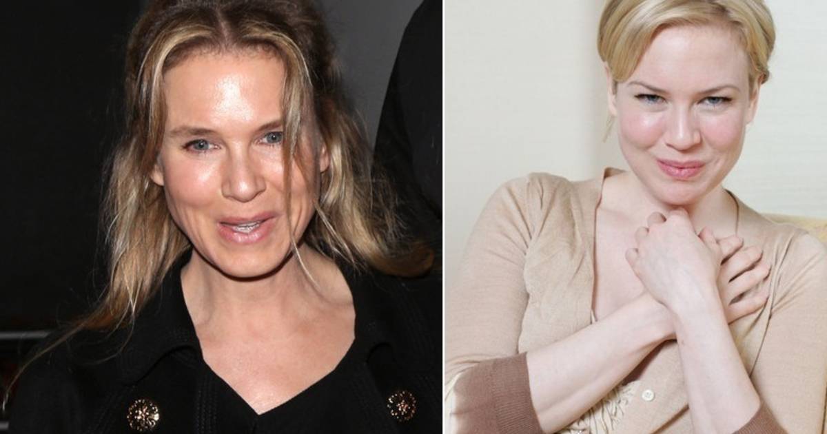 bridget jones onherkenbaar plastische chirurgie sterren ad nl
