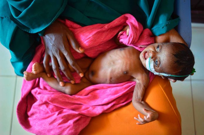 Onder andere in Zuid-Soedan, in het noordoosten van Afrika, heerst een zware hongersnood.