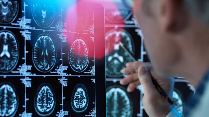 L'obésité aurait les mêmes effets sur le cerveau que la maladie d’Alzheimer